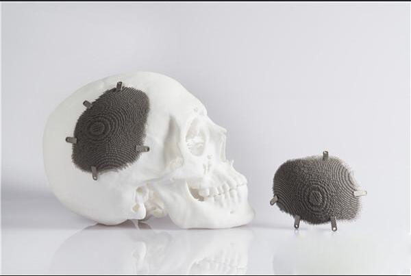 The future development of metal 3D printing: those things you don't know